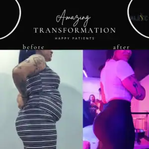 Awake Liposuction Lake Worth | Safe, Effective Body Contouring & Tummy Tuck 34 Majestic-Aesthetics-Before-After-Instagram-Post-27-300x300