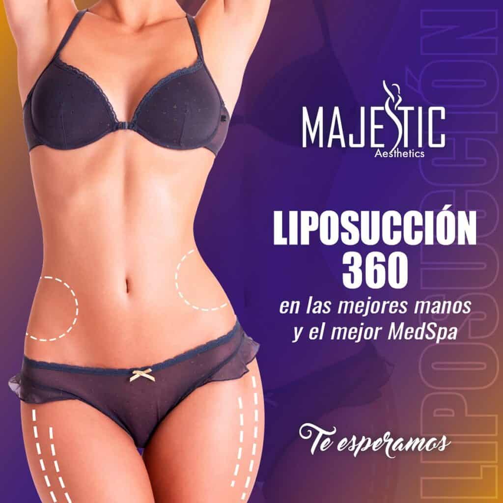 Fat Removal Boca Raton FL 13 Fat Removal Boca Raton FL 12